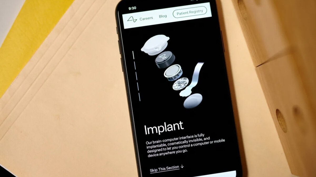 Neuralink Илона Маска получила разрешение на испытания мозгового чипа в Канаде