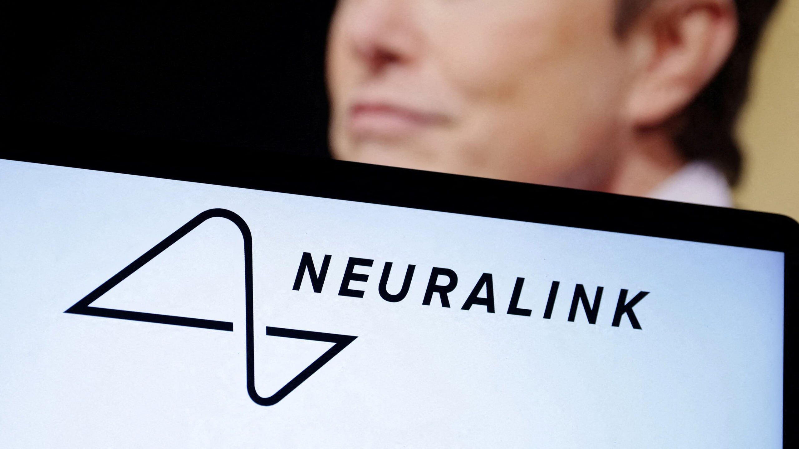 Компания Илона Маска Neuralink вживила нейрочип в мозг второго пациента